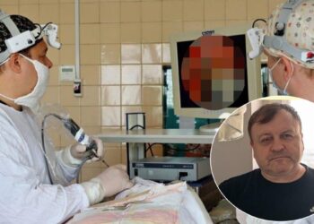 Göz ağrısı sandı, kafasından çıkan şey doktorları şaşkına çevirdi