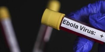 Avrupa’nın göbeğinde ‘Ebola’ alarmı! Hastaneler ve doktorlar harekete geçirildi