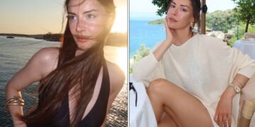 Kızılcık Şerbeti’nin Çimen’i estetik pişmanlığını açıkladı! Selin Türkmen dolgularını erittirdi